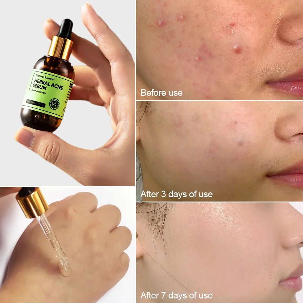 Herbal Facial Skin Care 2PCS/Set (Face/ Cream/ Serum) Bellezza Soul