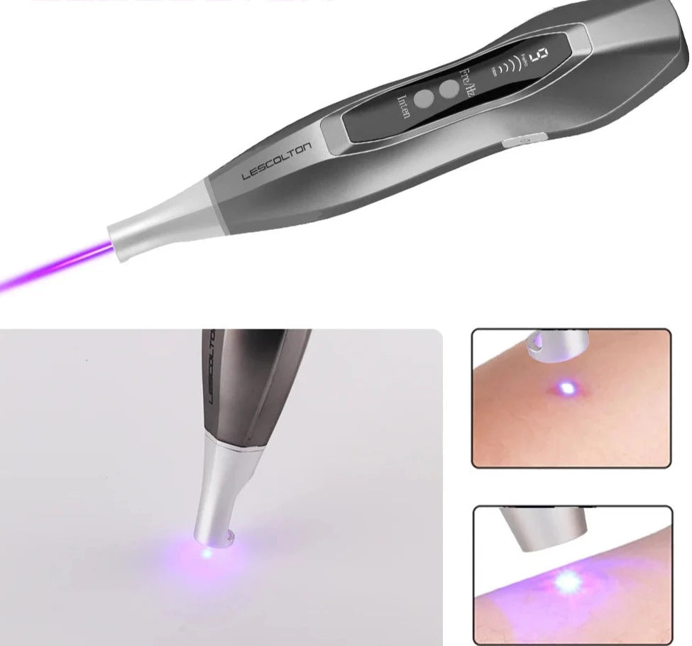 Removal Laser Pen(Freckle/Tattoo/ Dark Spot) Bellezza Soul